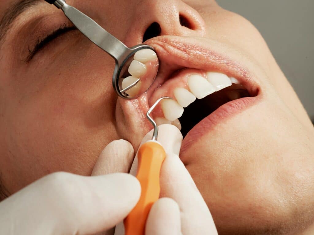 Japon, le pari fou d'un m&eacute;dicament pour faire repousser les dents.